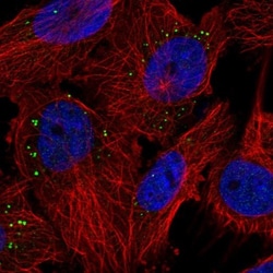 PIGP Antibody, Novus Biologicals:Antibodies:Primary Antibodies